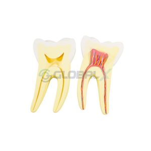 Modelo Expansivo Dente Humano - 3 tipos